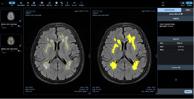 drbrain-3.png